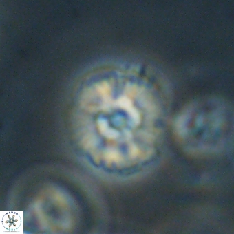 Cyclagelosphaera paez rayesii 67318