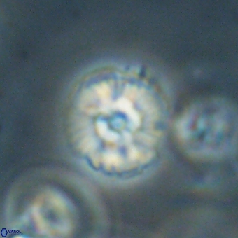 Cyclagelosphaera paez rayesii 67319