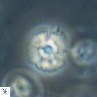 Cyclagelosphaera paez rayesii 67319