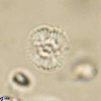 Cyclagelosphaera paez rayesii 67320