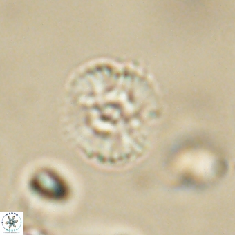 Cyclagelosphaera paez rayesii 67320
