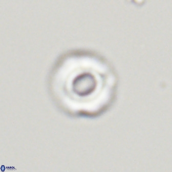Cyclagelosphaera perforata 41516