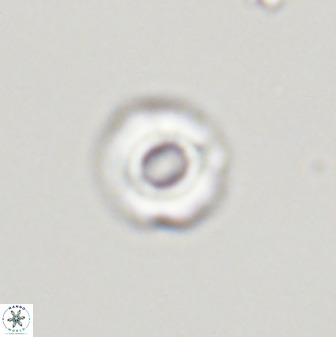 Cyclagelosphaera perforata 41516