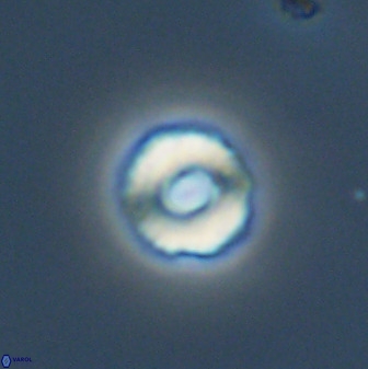 Cyclagelosphaera perforata 41517