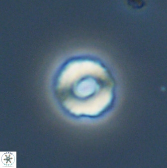 Cyclagelosphaera perforata 41517