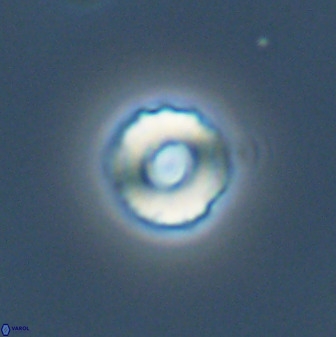 Cyclagelosphaera perforata 41518