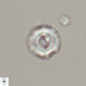 Cyclagelosphaera perforata 13761