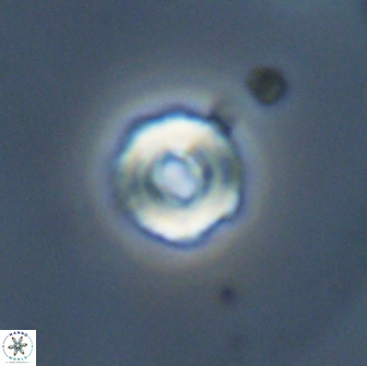 Cyclagelosphaera perforata 13762
