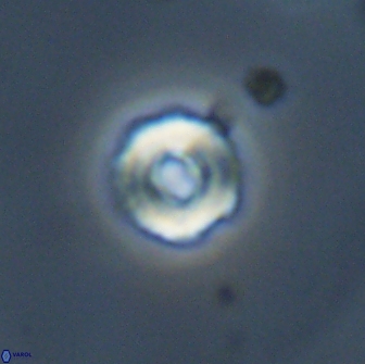 Cyclagelosphaera perforata 13763