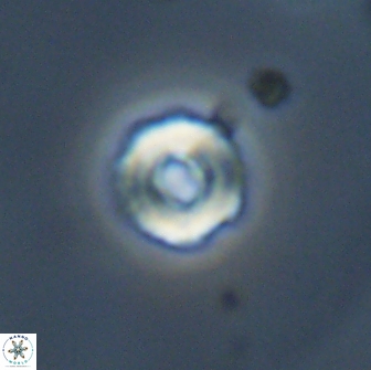 Cyclagelosphaera perforata 13763