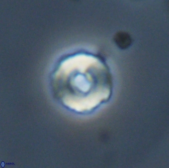 Cyclagelosphaera perforata 13764