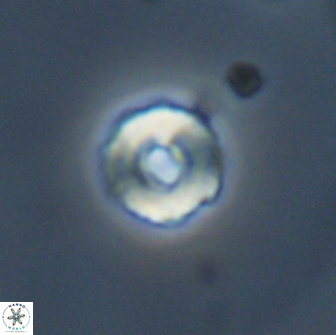 Cyclagelosphaera perforata 13764