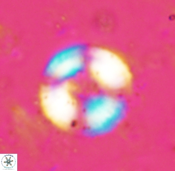 Cyclagelosphaera spp1854