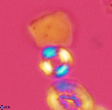 Cyclagelosphaera perforata 3225