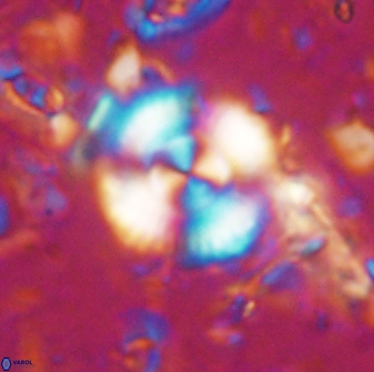 Cyclagelosphaera reinhardtii 15487