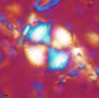 Cyclagelosphaera reinhardtii 15488