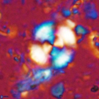 Cyclagelosphaera reinhardtii 15495