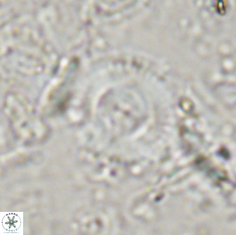 Cyclagelosphaera reinhardtii 15490