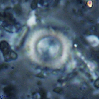 Cyclagelosphaera reinhardtii 15491