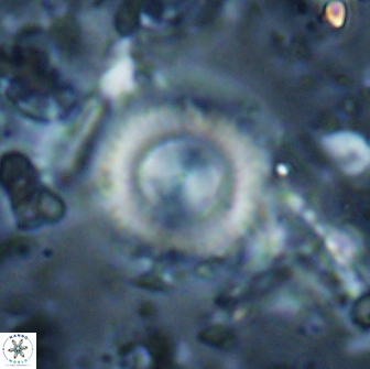 Cyclagelosphaera reinhardtii 15491