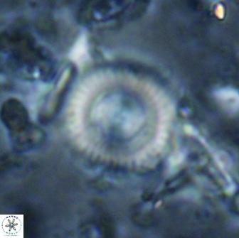 Cyclagelosphaera reinhardtii 15493