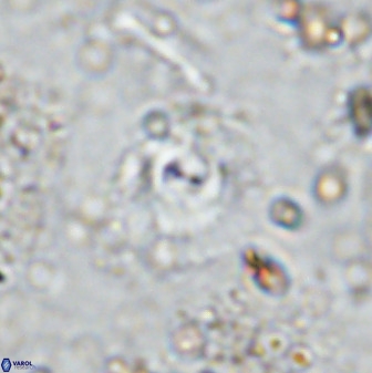 Cyclagelosphaera reinhardtii 35754