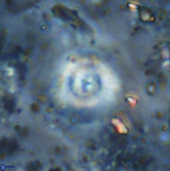 Cyclagelosphaera reinhardtii 35755