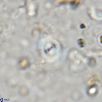 Cyclagelosphaera reinhardtii 36638