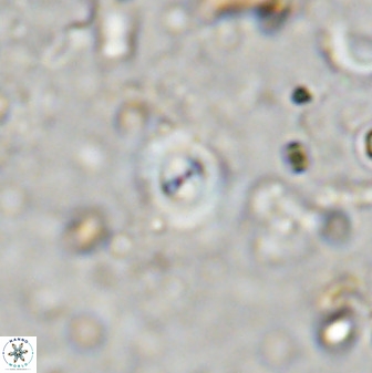 Cyclagelosphaera reinhardtii 36638