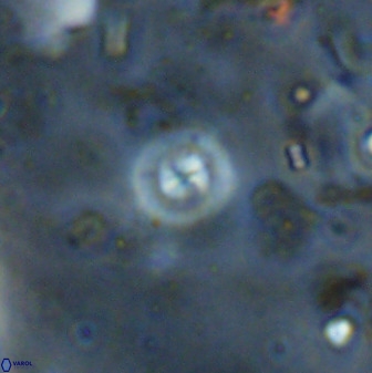 Cyclagelosphaera reinhardtii 36639