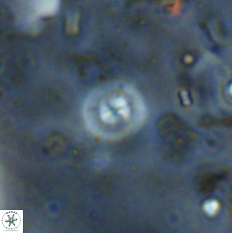 Cyclagelosphaera reinhardtii 36639