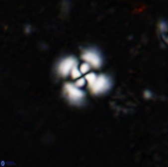 Cyclagelosphaera reinhardtii 36631
