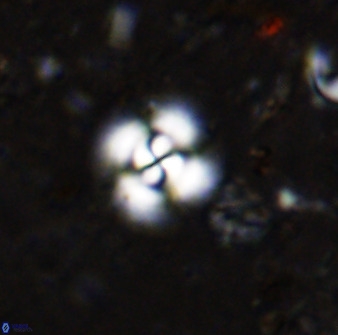 Cyclagelosphaera reinhardtii 36633