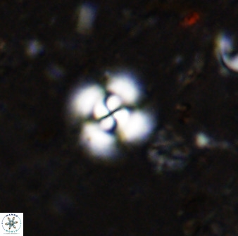 Cyclagelosphaera reinhardtii 36633