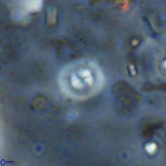 Cyclagelosphaera reinhardtii 36640