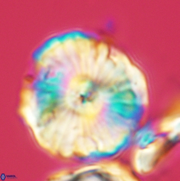 Cyclagelosphaera riyadhensis 3793
