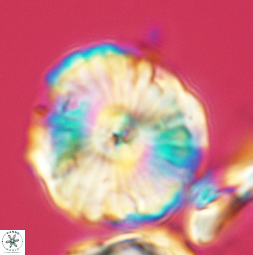 Cyclagelosphaera riyadhensis 3793