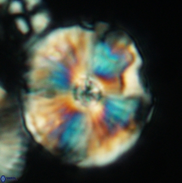 Cyclagelosphaera riyadhensis 3794