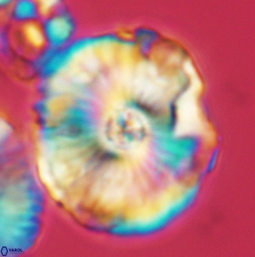 Cyclagelosphaera riyadhensis 3795