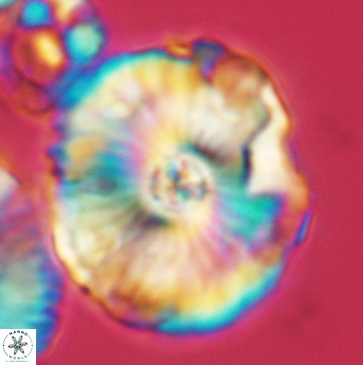 Cyclagelosphaera riyadhensis 3795