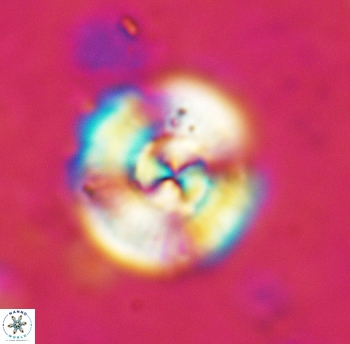 Cyclagelosphaera reinhardtii 5399