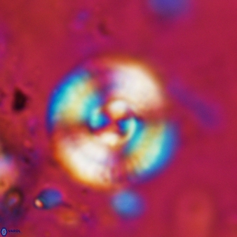 Cyclagelosphaera reinhardtii 871