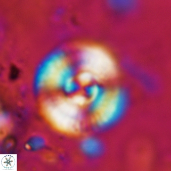 Cyclagelosphaera reinhardtii 871