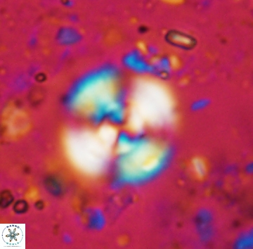 Cyclagelosphaera reinhardtii 1140