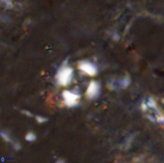 Cyclagelosphaera rotaclypeata 37018