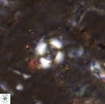 Cyclagelosphaera rotaclypeata 37018