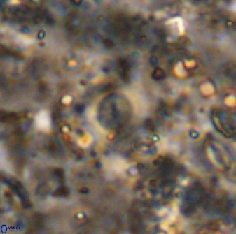 Cyclagelosphaera rotaclypeata 37021