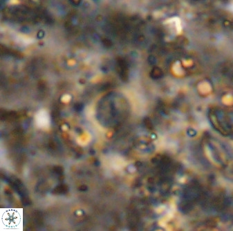 Cyclagelosphaera rotaclypeata 37021
