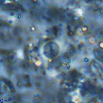 Cyclagelosphaera rotaclypeata 37022