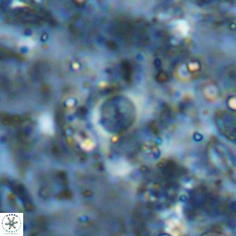 Cyclagelosphaera rotaclypeata 37022